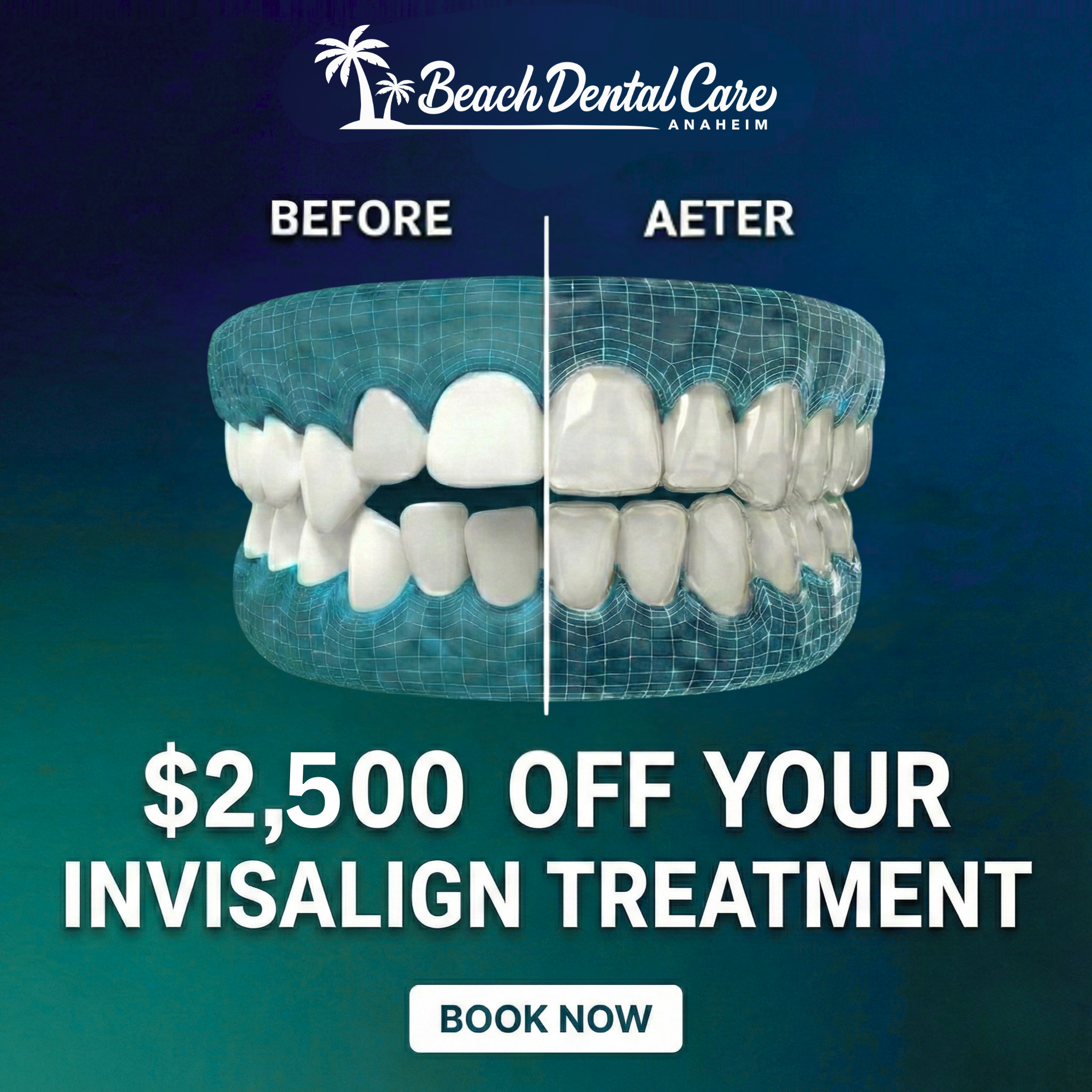 Beach Dental Care Anaheim Facebook ad: Get $2,500 OFF Invisalign + Payment Plans as Low as…