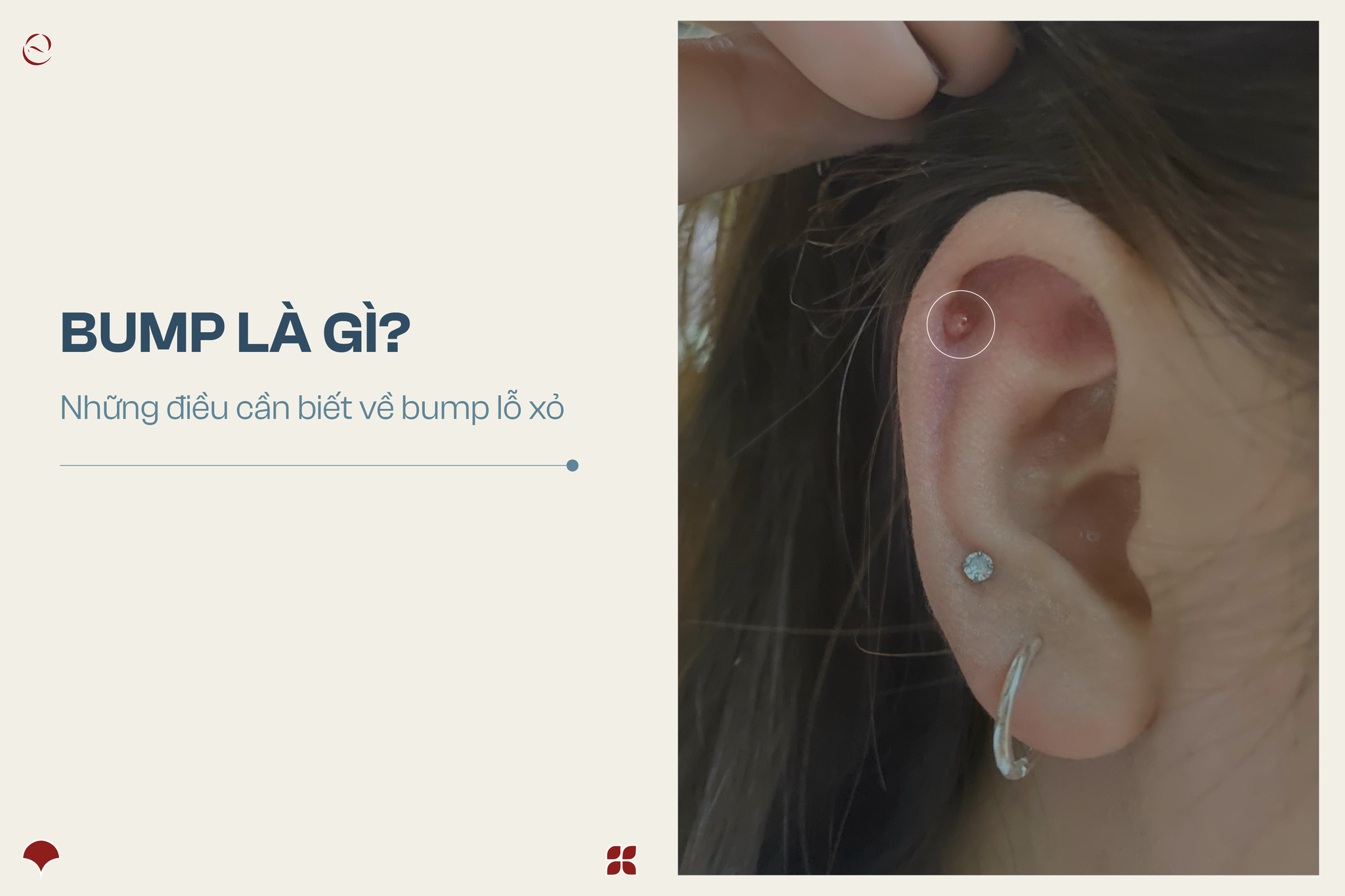 Elegant Xỏ - Khuyên Facebook ad: BUMP LỖ XỎ & NHỮNG ĐIỀU CẦN BIẾT…
