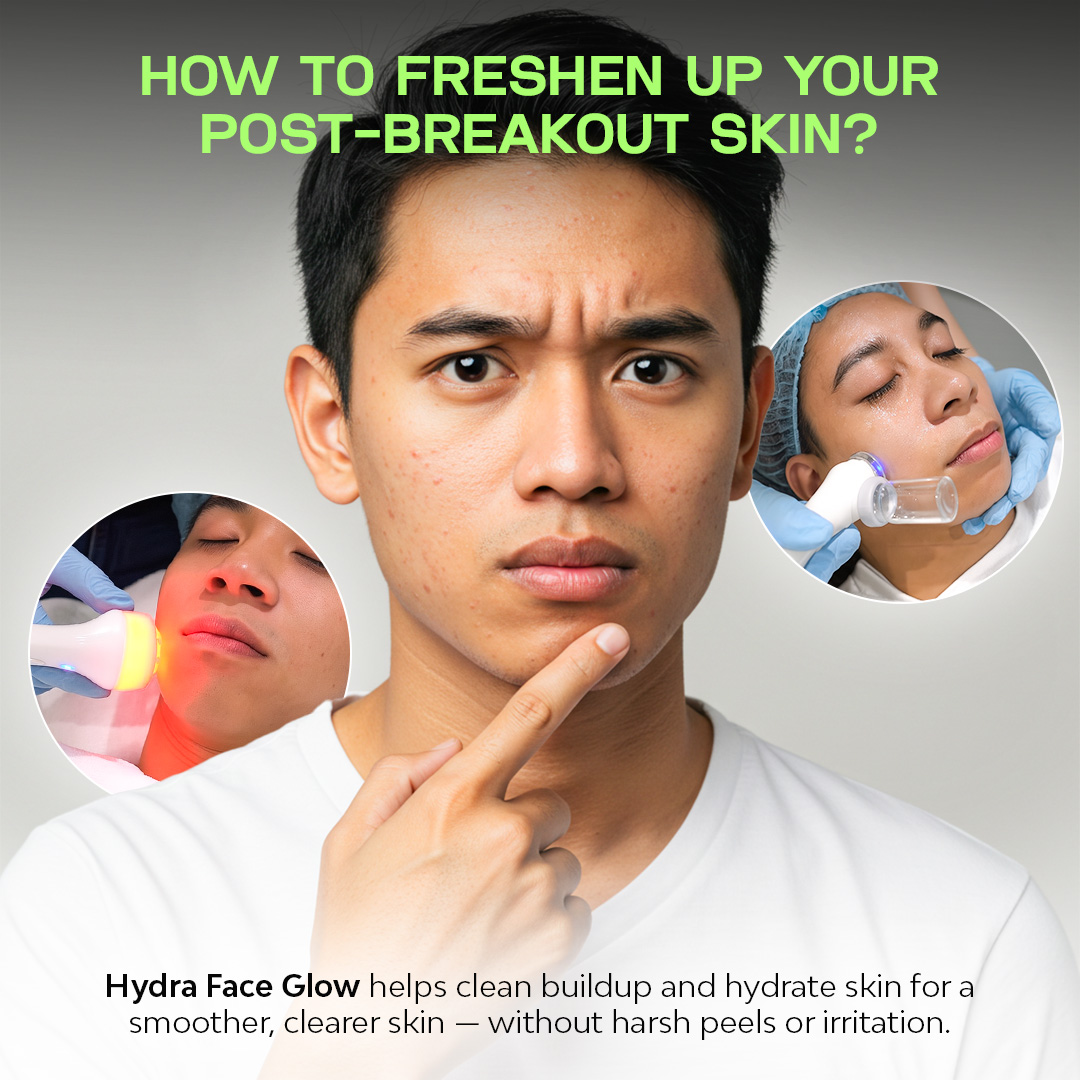 Venus Aesthetics.PH Facebook ad: Hydra Face Glow | P599