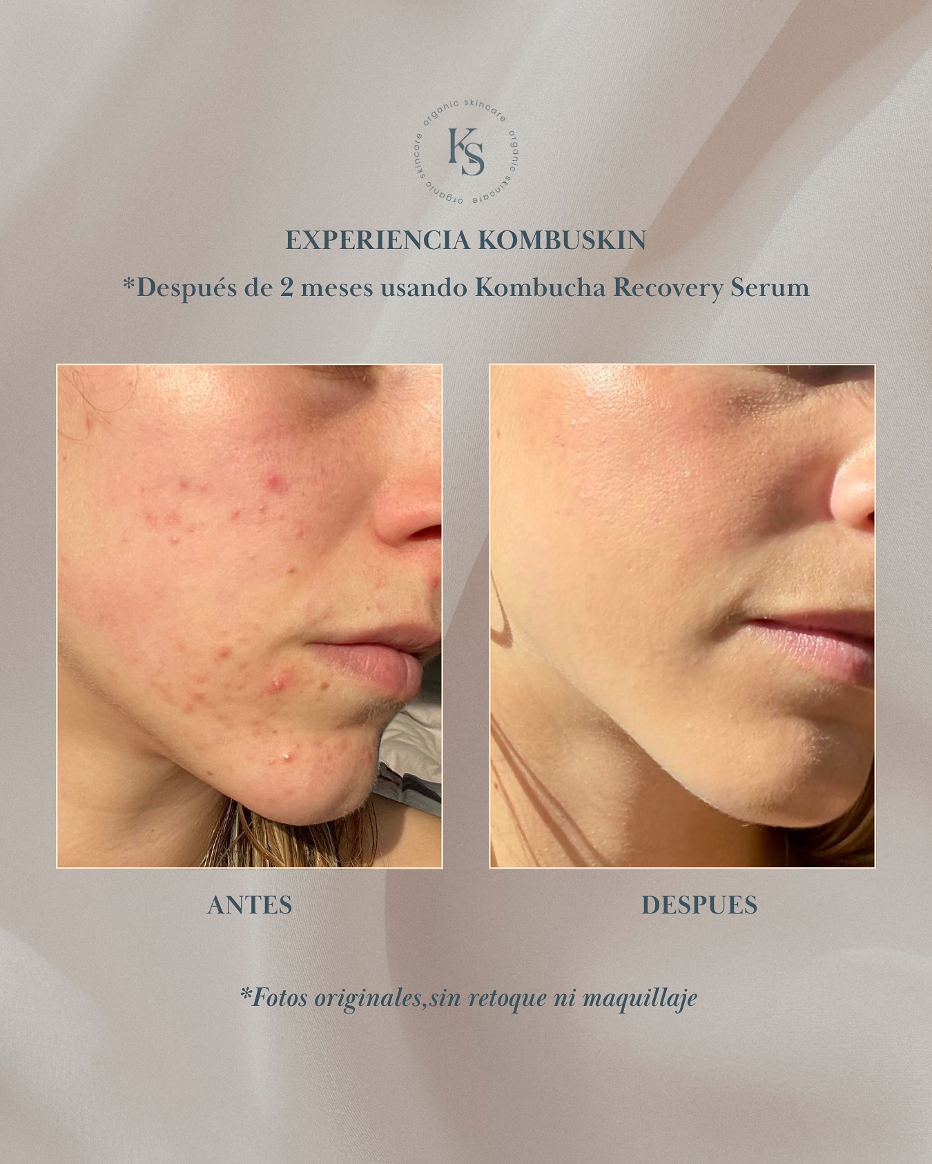 Kombuskin Facebook ad: Experiencia Kombuskin Maca nos compartió su testimonio con…