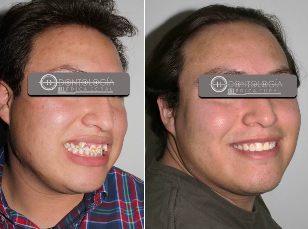 Odontología Médica Coral Facebook ad: Sonríe con Confianza