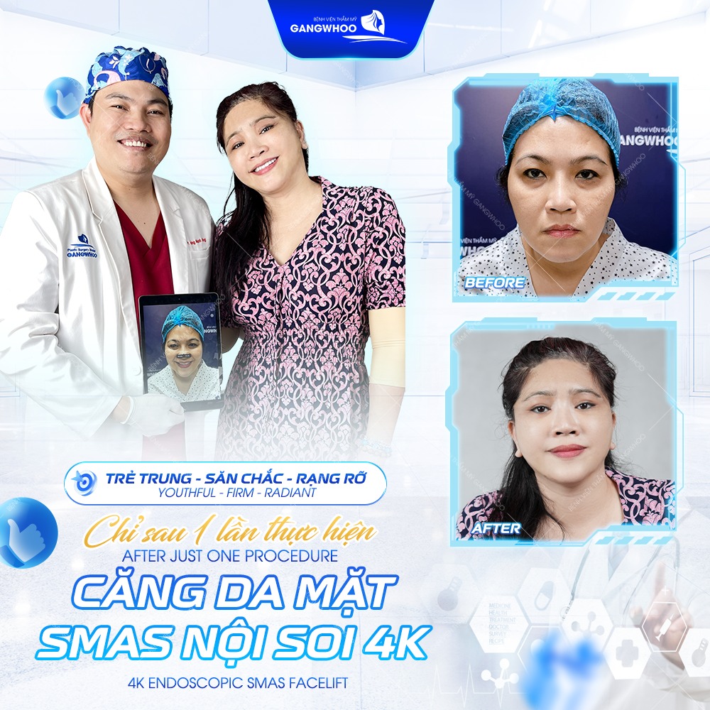 Bệnh viện thẩm mỹ Gangwhoo Facebook ad