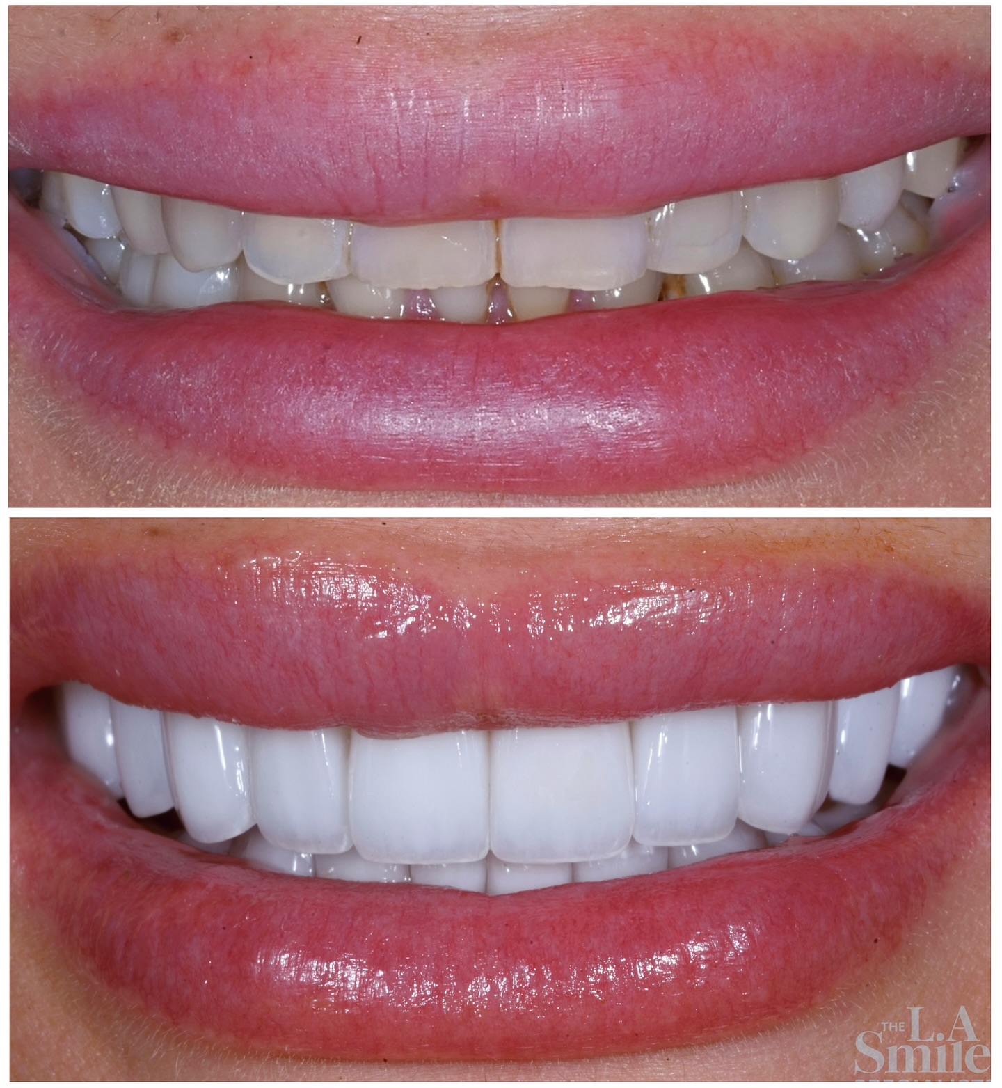 L.A. Smile Specialists Facebook ad: Giving this patient a beautiful bright natural smile…