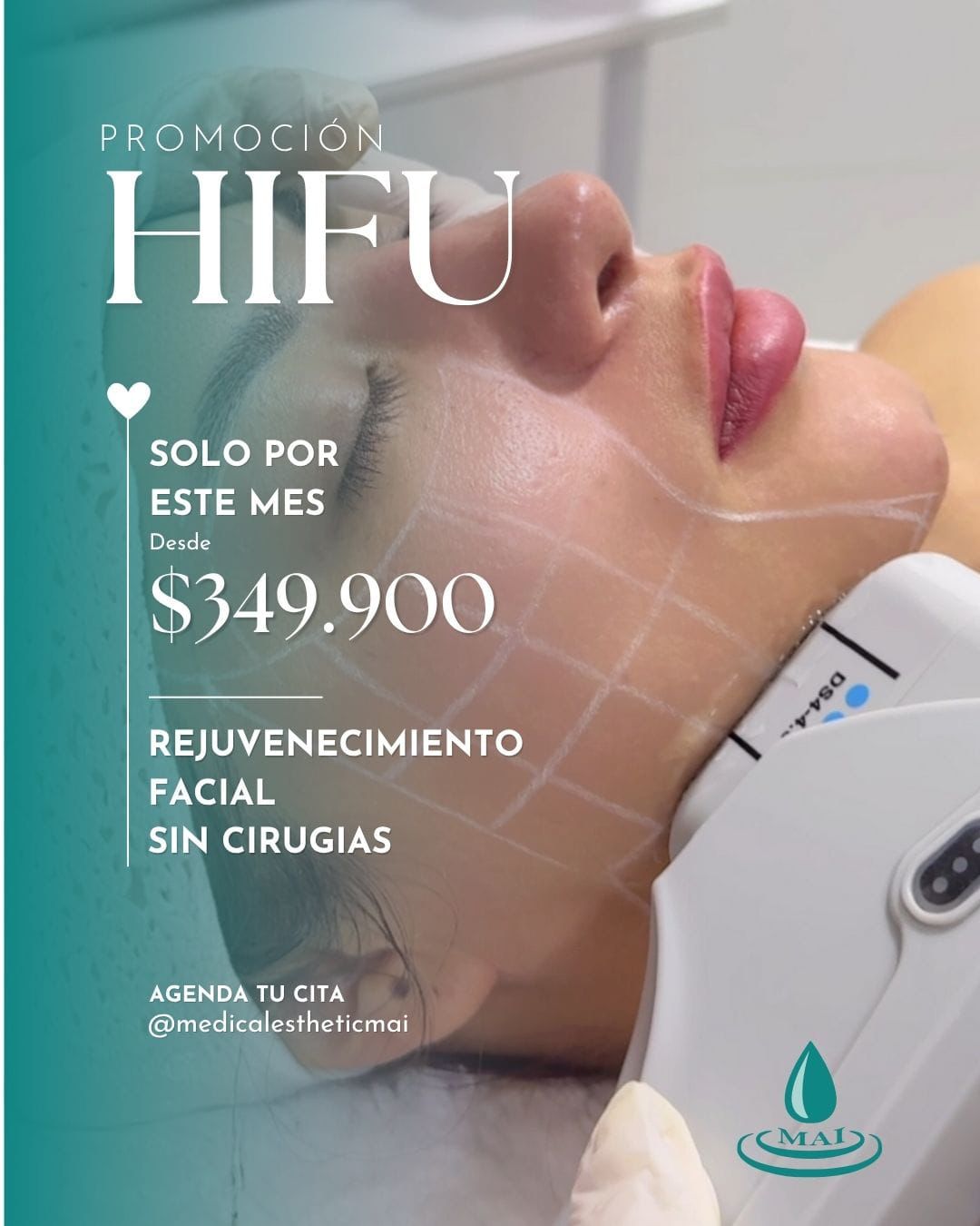 Medical Esthetic Spa MAI Facebook ad: HIFU facial + bono de $170,000 para potenciar resultados