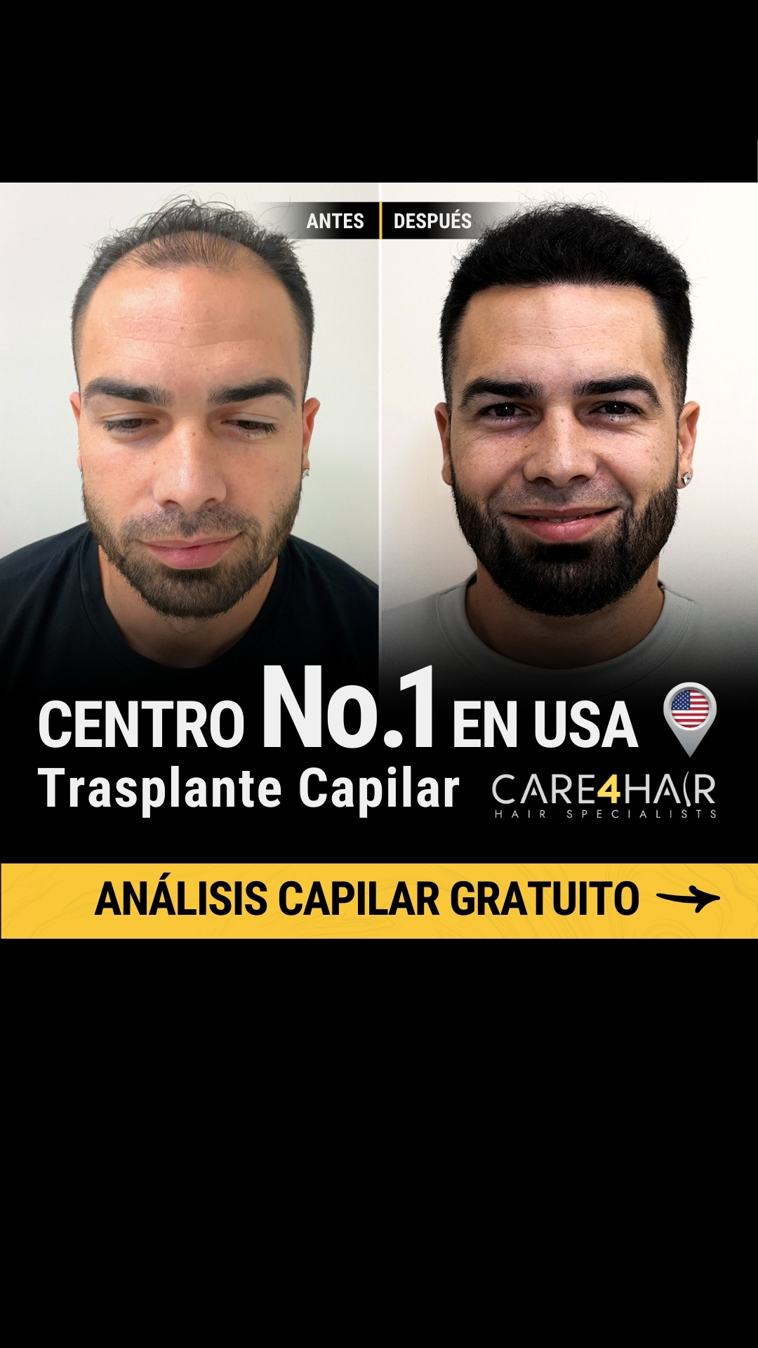 Care4Hair Facebook ad