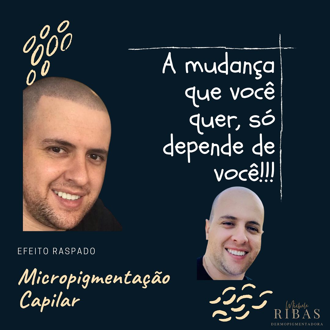Clinica Capilar Scalp Master Facebook ad
