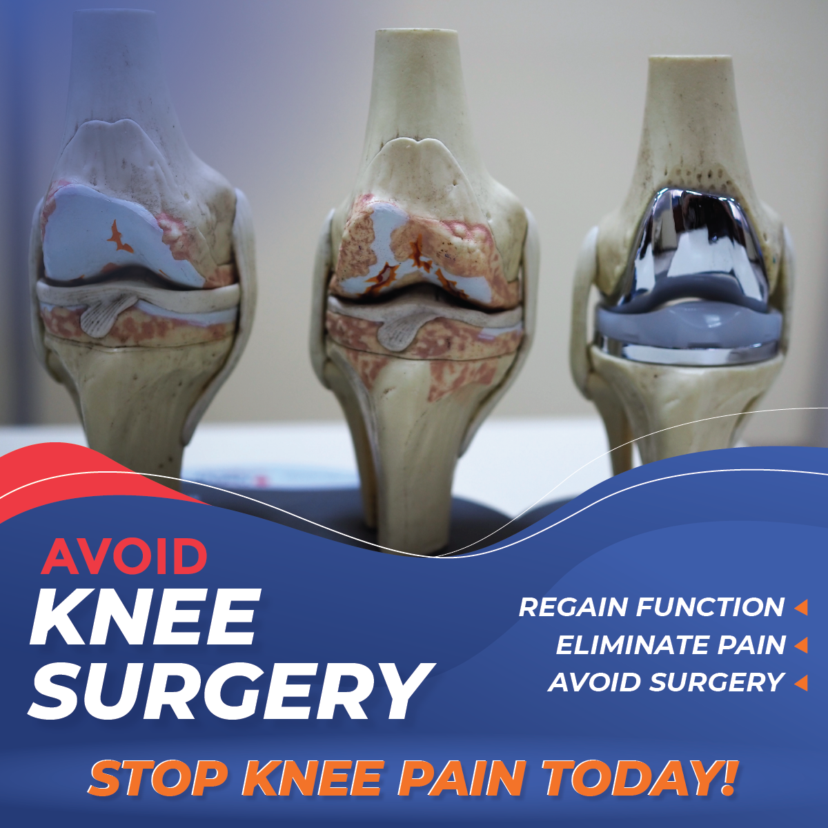 Advanced Knee Relief Protocol without Surgery Facebook ad: Breakthrough Treatment for Knee Pain Relief