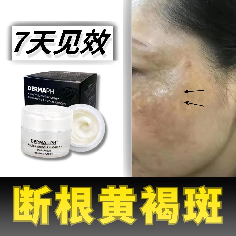 诗诗祛斑店铺 Facebook ad
