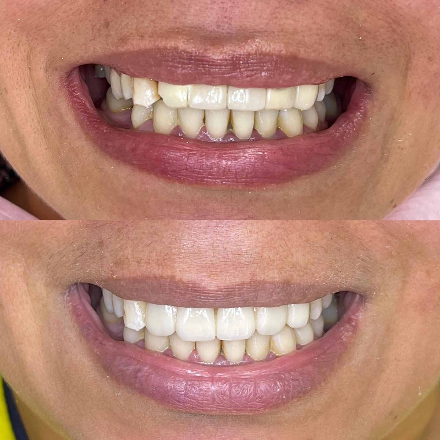 Clinica Dental Estudio32 Facebook ad: Clinica Dental Estudio 32 | Telde [ Reserva ahora ]
