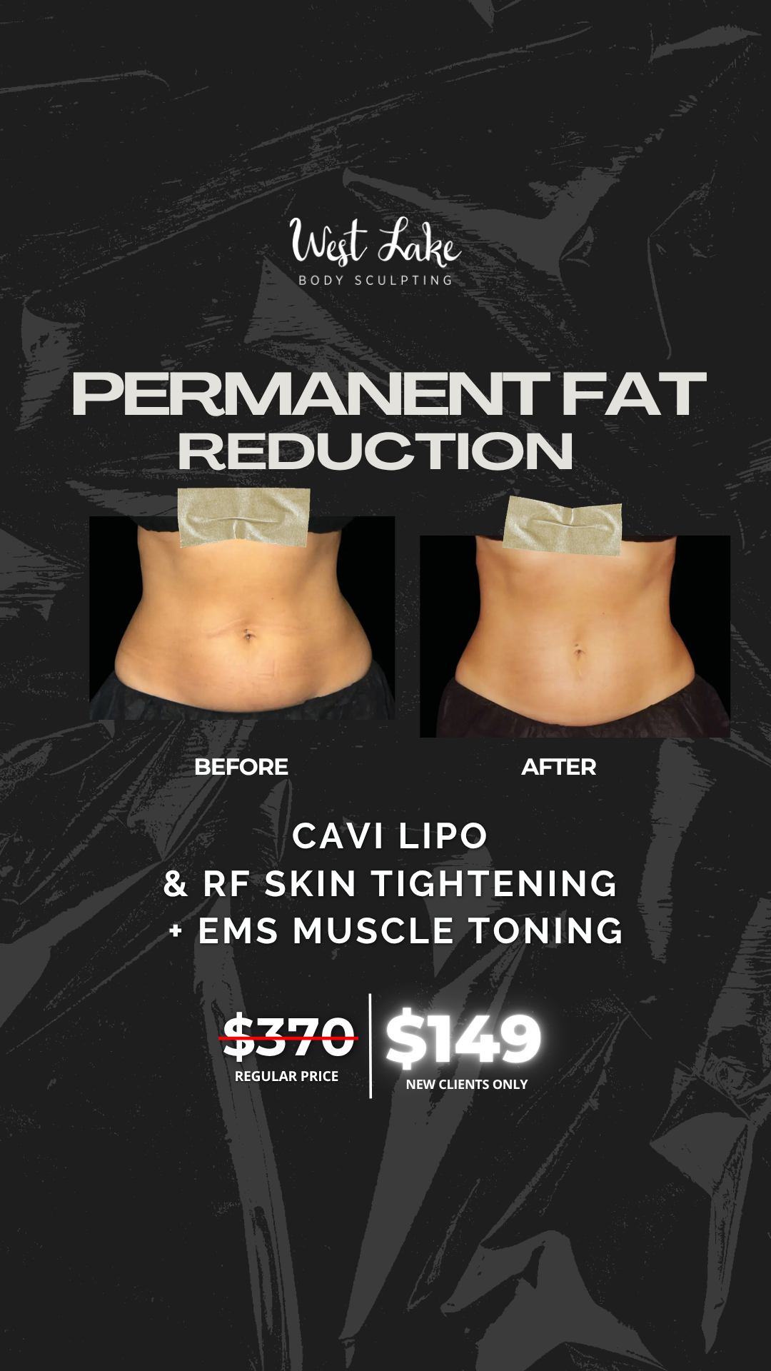 West Lake Body Sculpting - PR Facebook ad