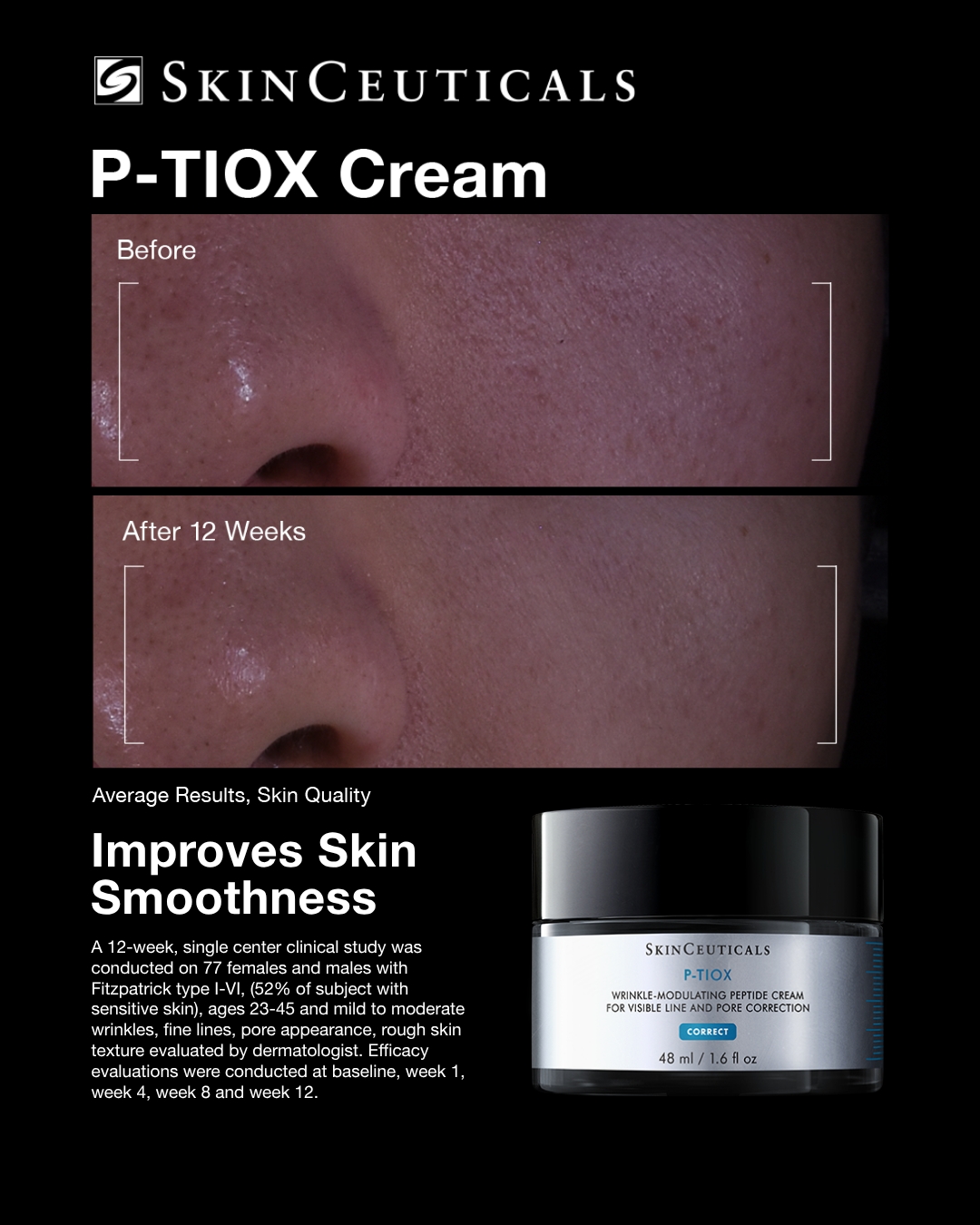 SkinCeuticals Facebook ad