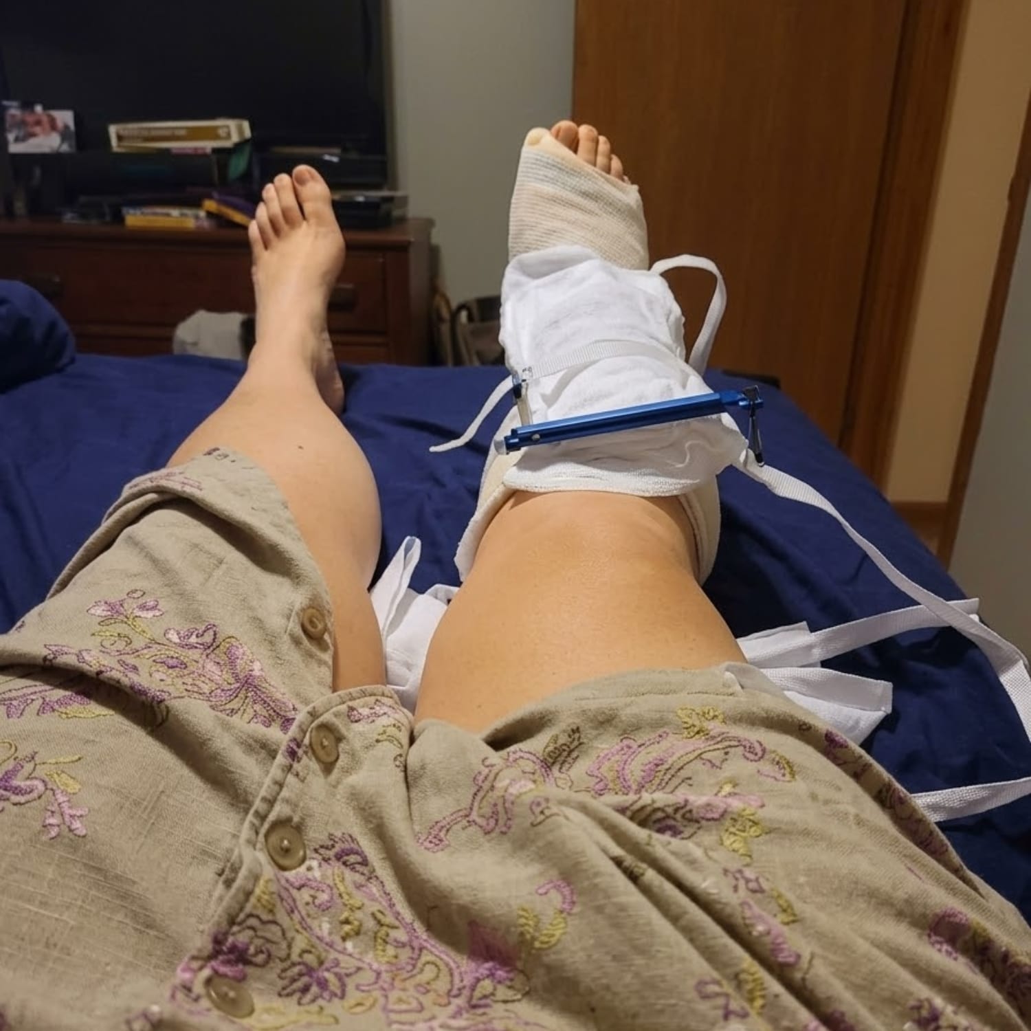Curalis Facebook ad: Before you consider surgery, read this.