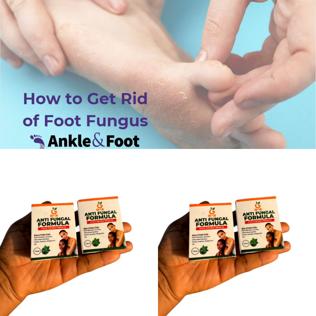 Fungal Natural Remedy Facebook ad