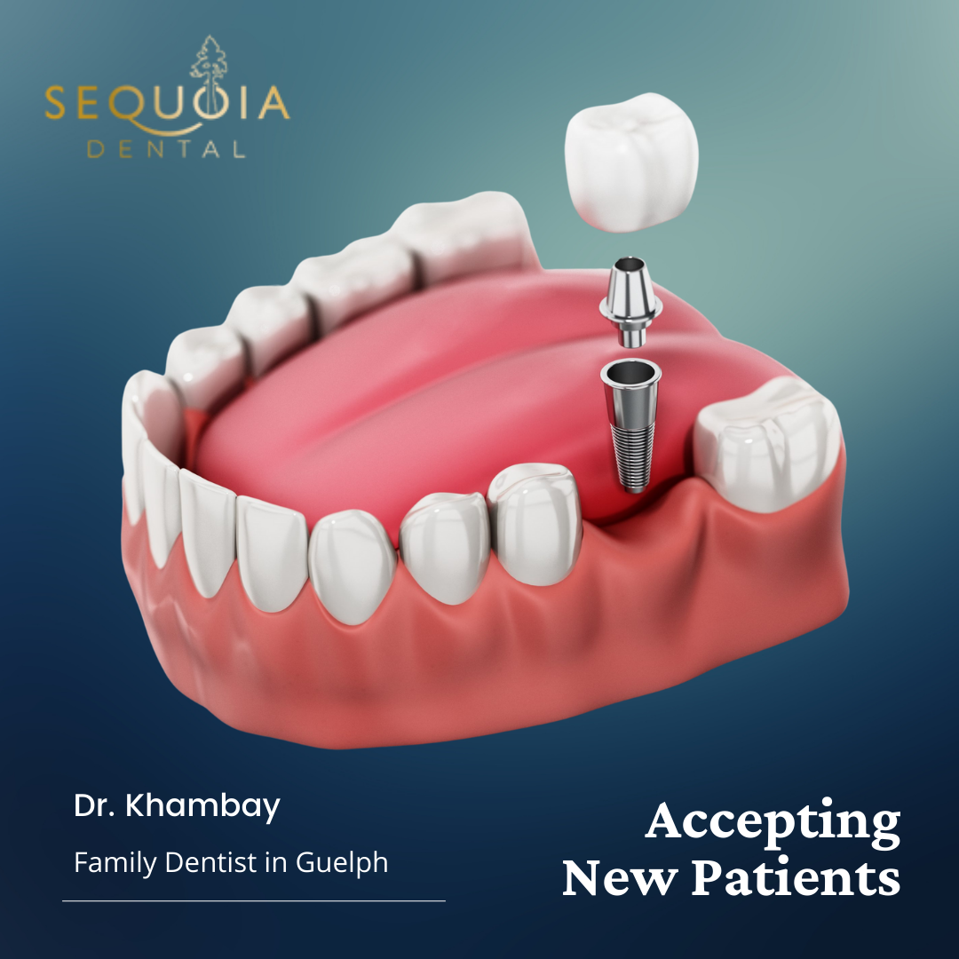 Sequoia Dental Facebook ad: SEQUOIA DENTAL GUELPH