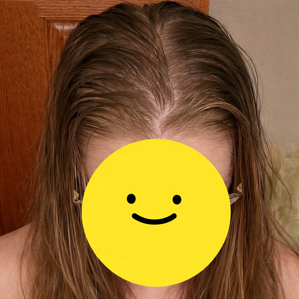 Ashwilliamms Facebook ad: Nurse explains why your GLP-1 hair loss won't stop