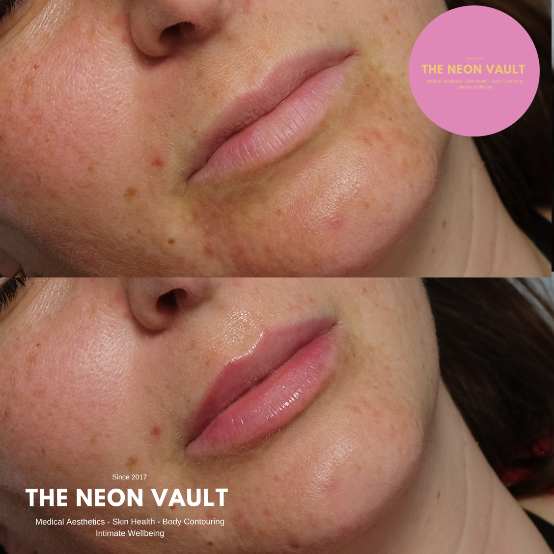The Neon Vault Facebook ad