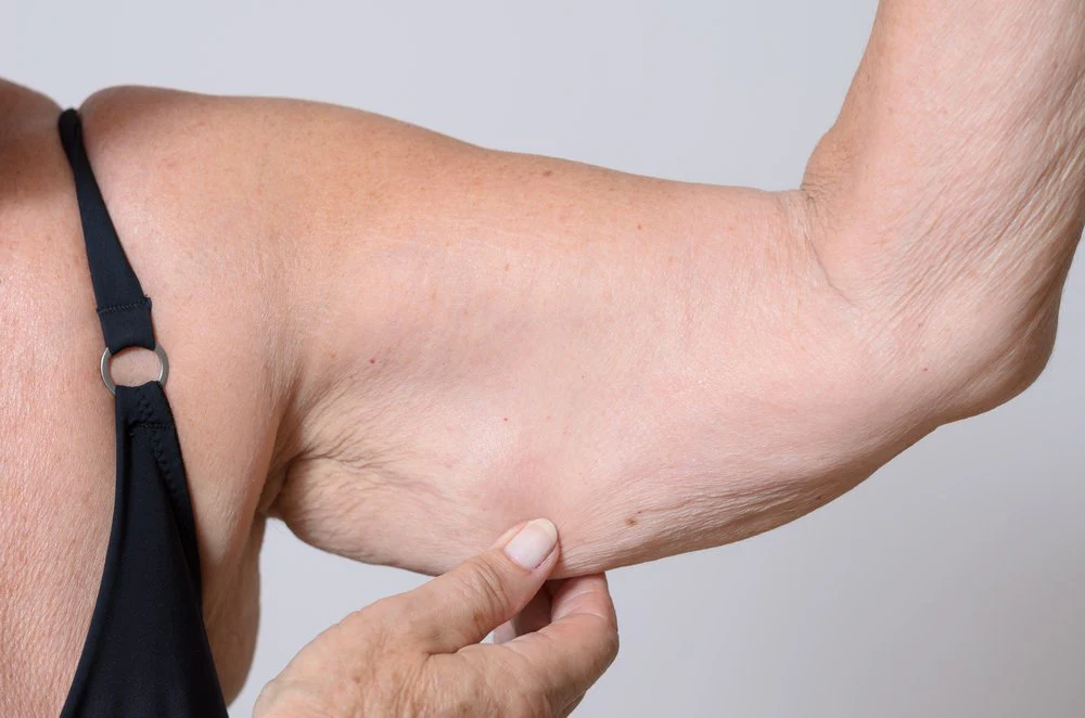 Jamie Whittingham Facebook ad: My Arms Started Sagging Like an Old Man's
