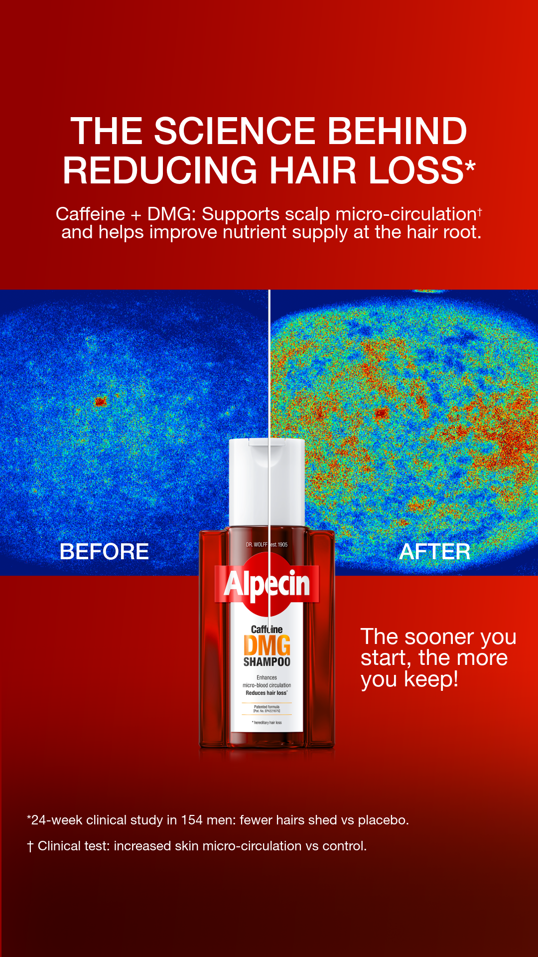 Alpecin Facebook ad: Alpecin DMG Shampoo & Serum