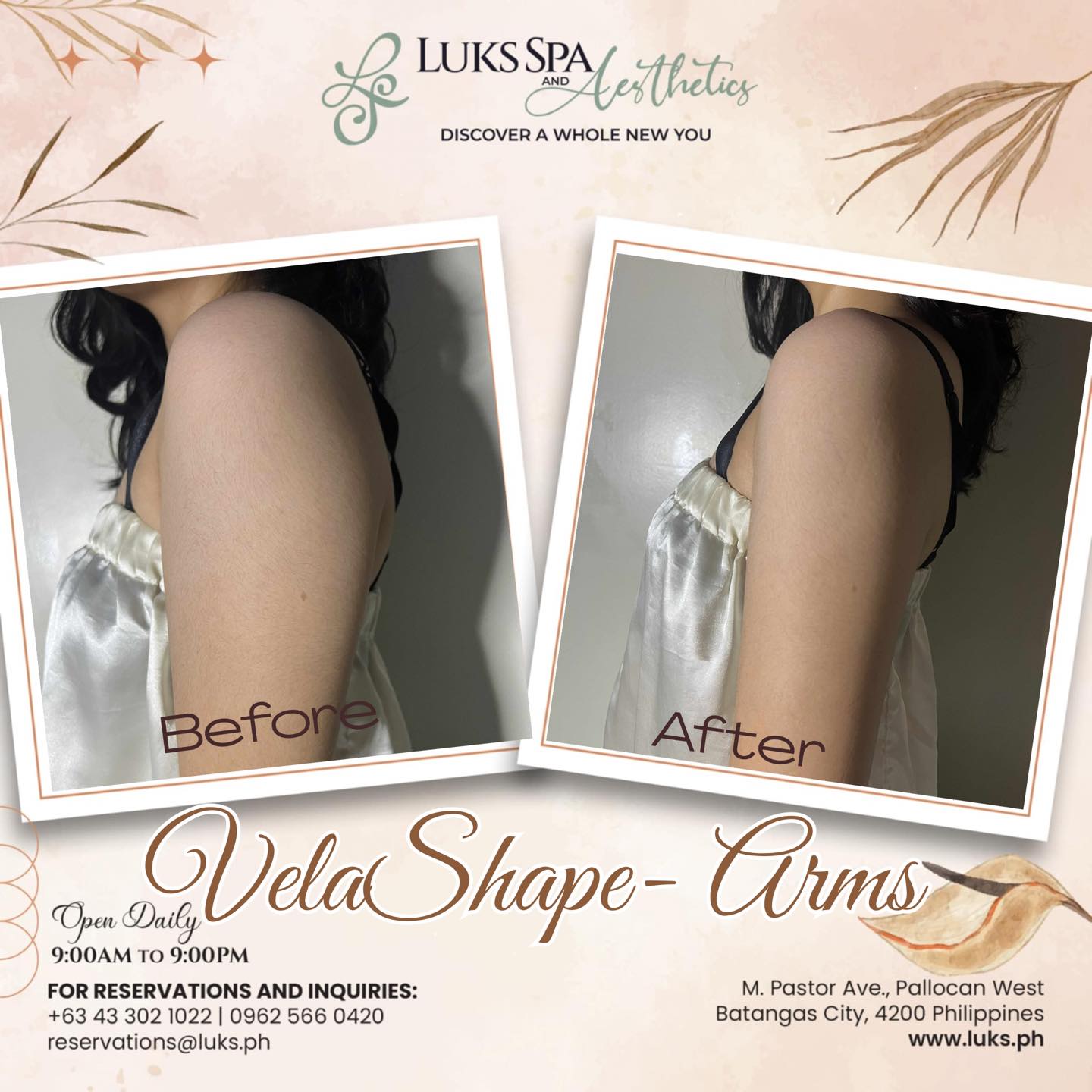 Luks Spa and Aesthetics Facebook ad: ๐๐ฅ๐ข๐ฆ๐ฆ๐๐ซ ๐๐ซ๐ฆ๐ฌ, ๐ฌ๐ญ๐ซ๐จ๐ง๐ ๐๐ซ ๐๐ก๐๐ซ๐ฆ