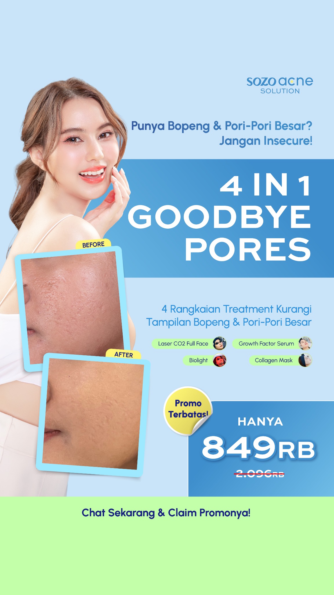 Sozo Acne Facebook ad