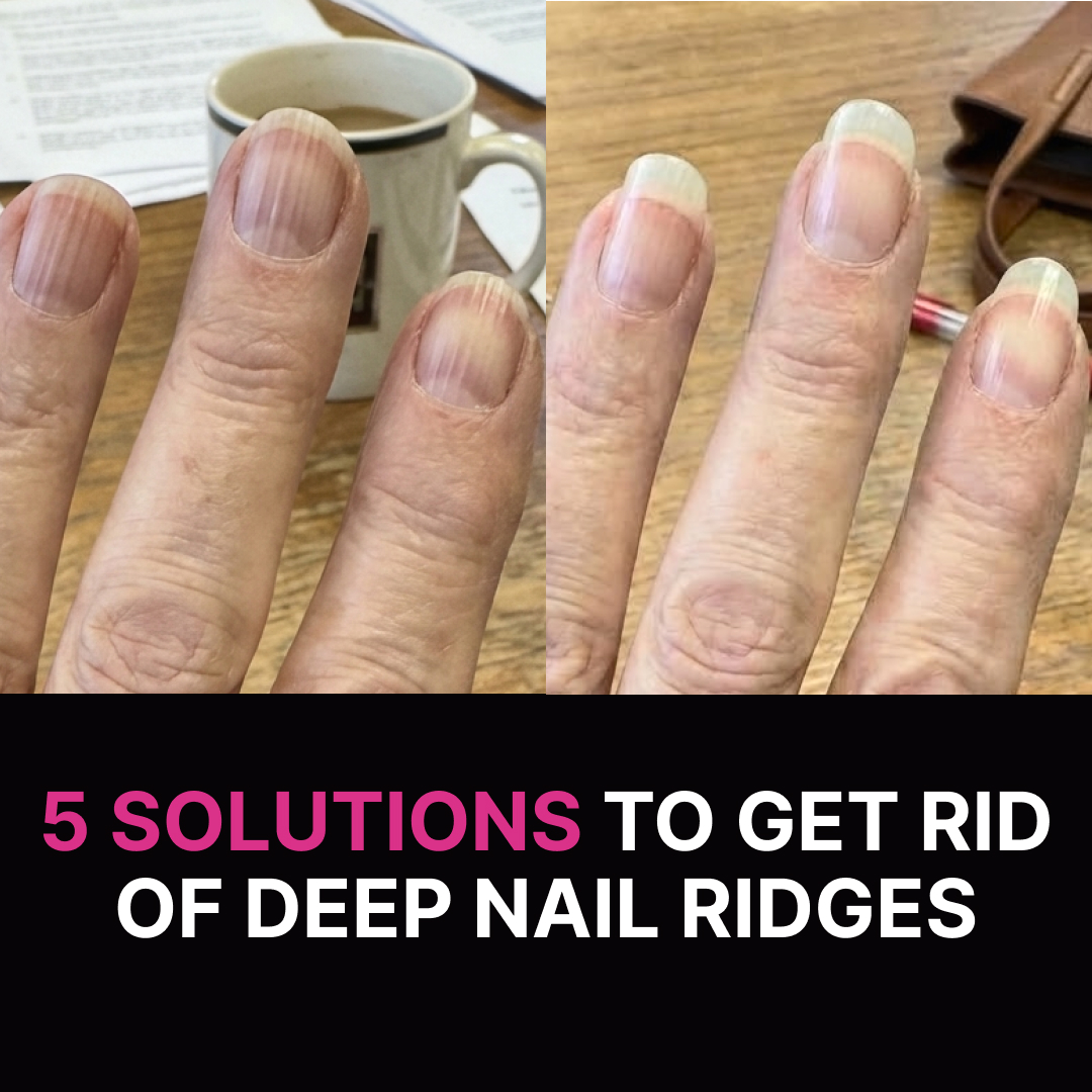 Daily Beauty Notes Facebook ad: Read this before buffing your ridged nails