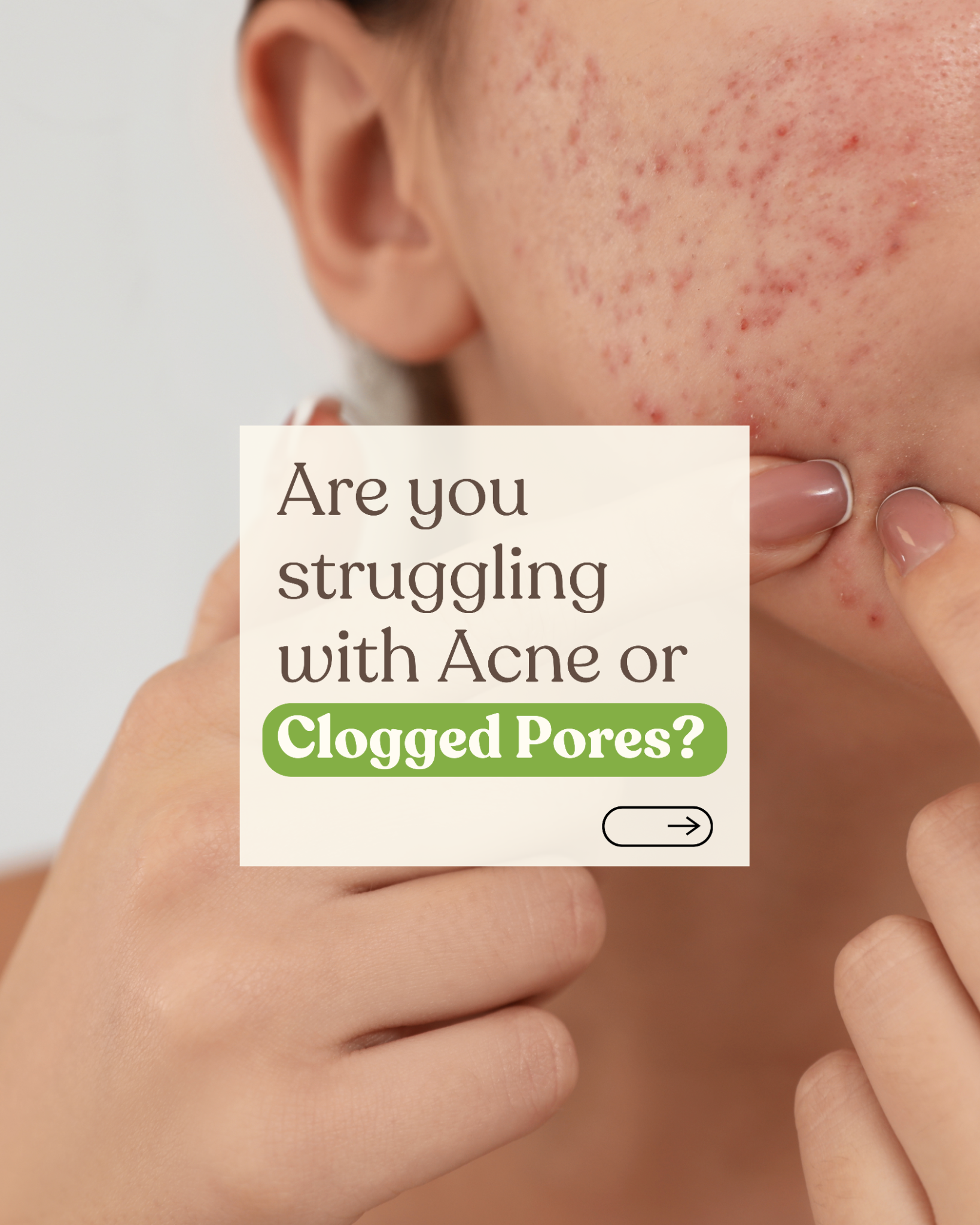 Organic Lab SkinJoy Facebook ad