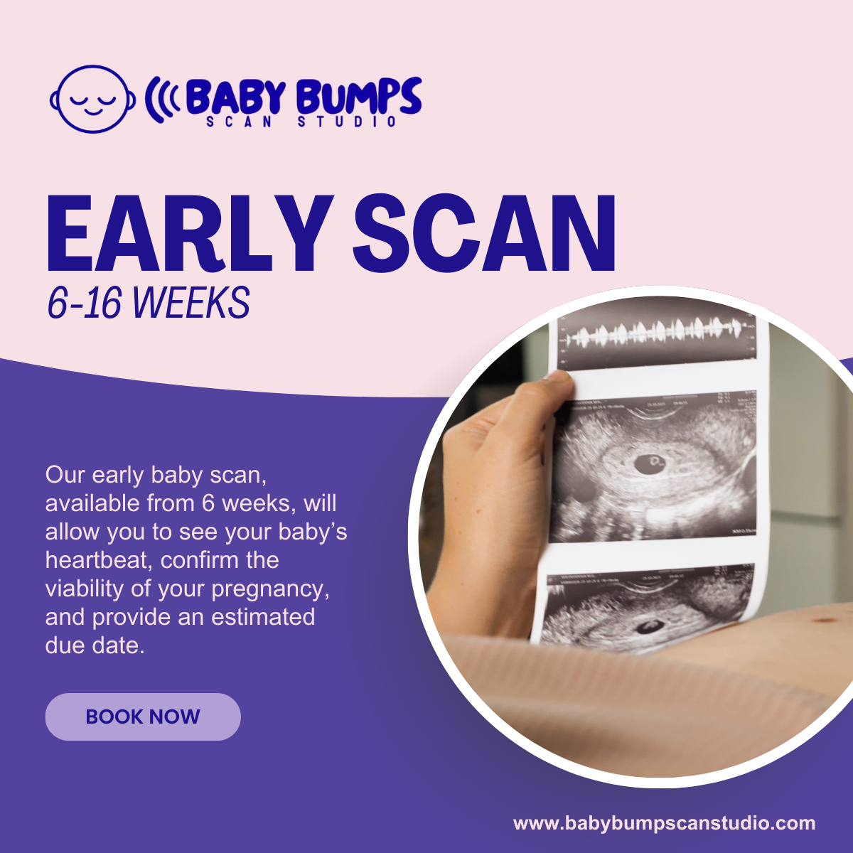 Baby Bumps Scan Studio Facebook ad: If we’re unable to obtain satisfactory images on…