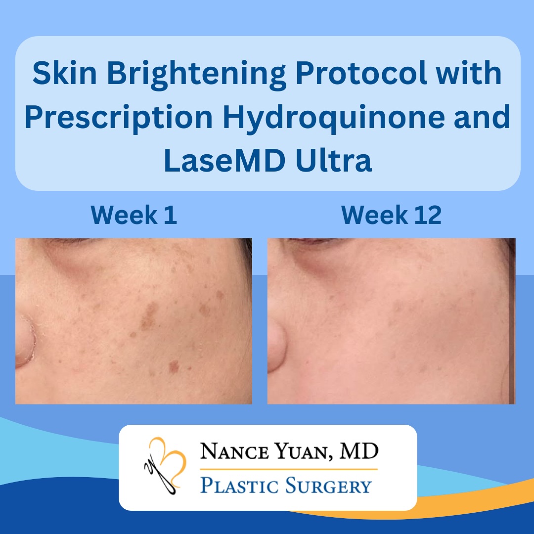 Nance Yuan, MD Plastic Surgery Facebook ad
