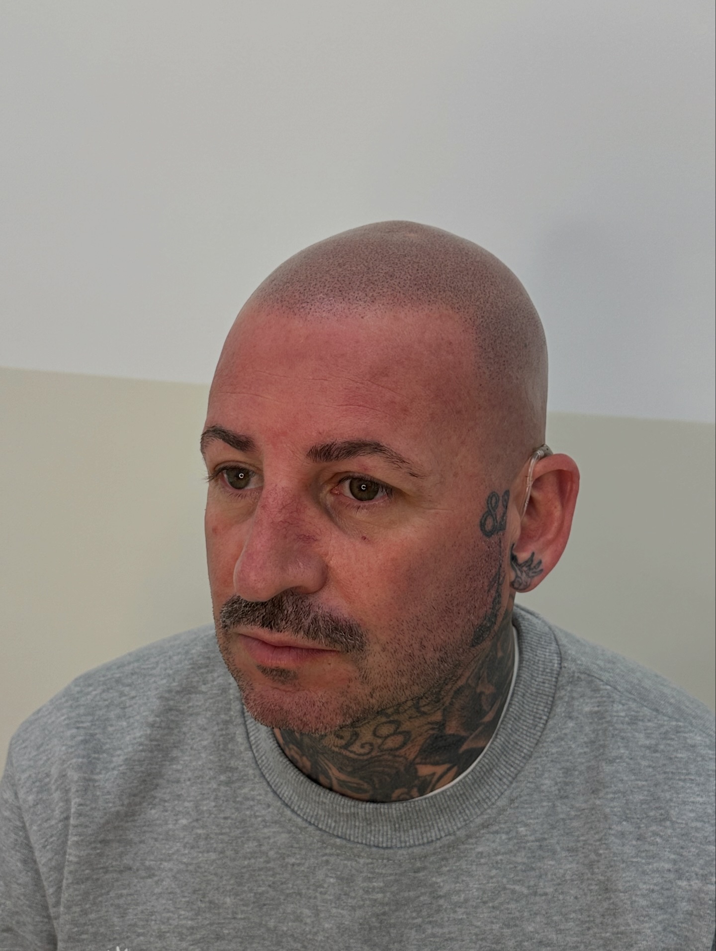 Brow Designer Angelo Tanzi Facebook ad: Trico pigmentazione.