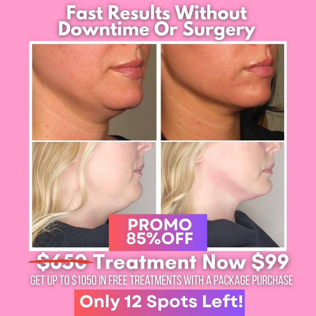 Body Techs Rx Wellness + Rehab Center Facebook ad