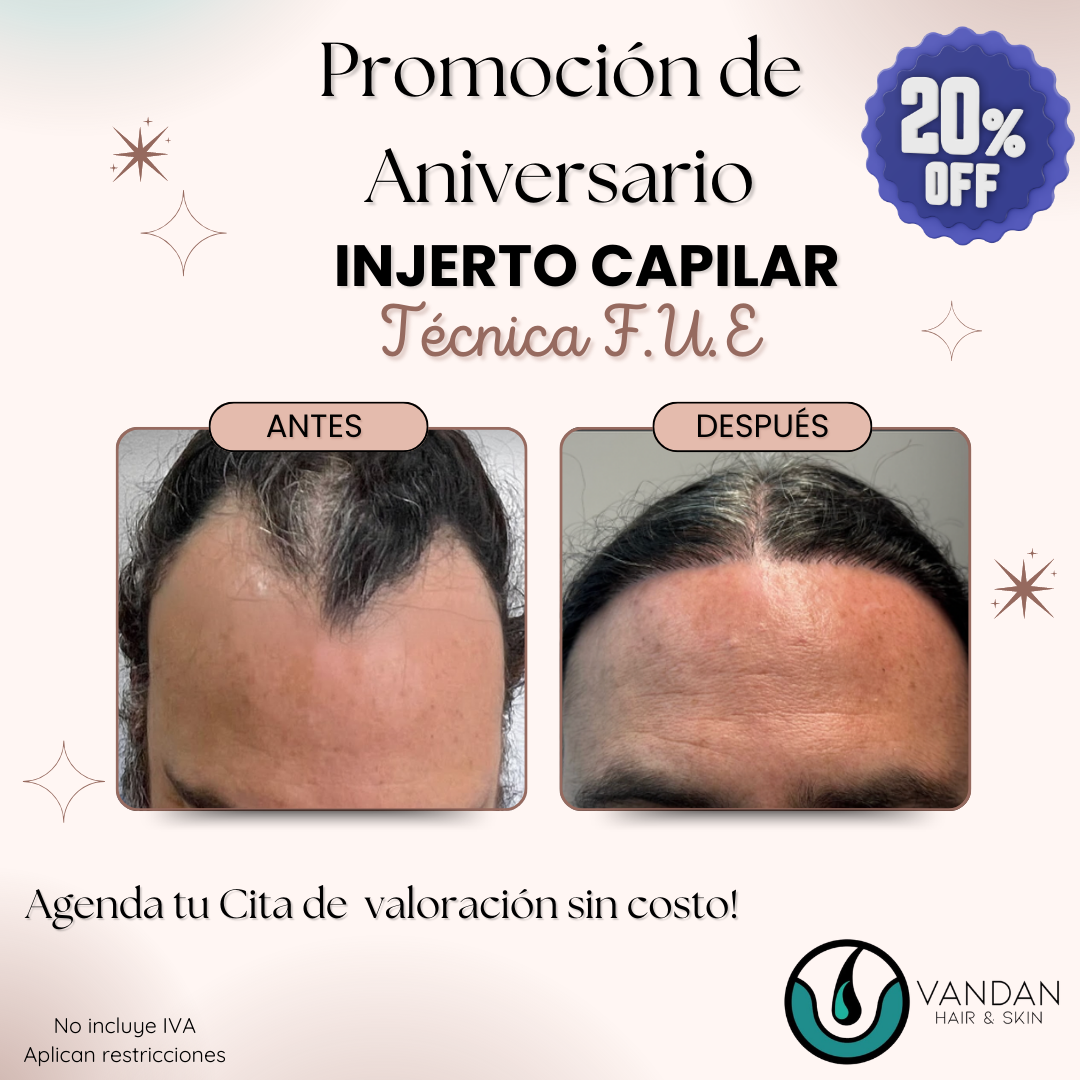 Vandan Hair & Skin Facebook ad: Promoción especial por séptimo aniversario.