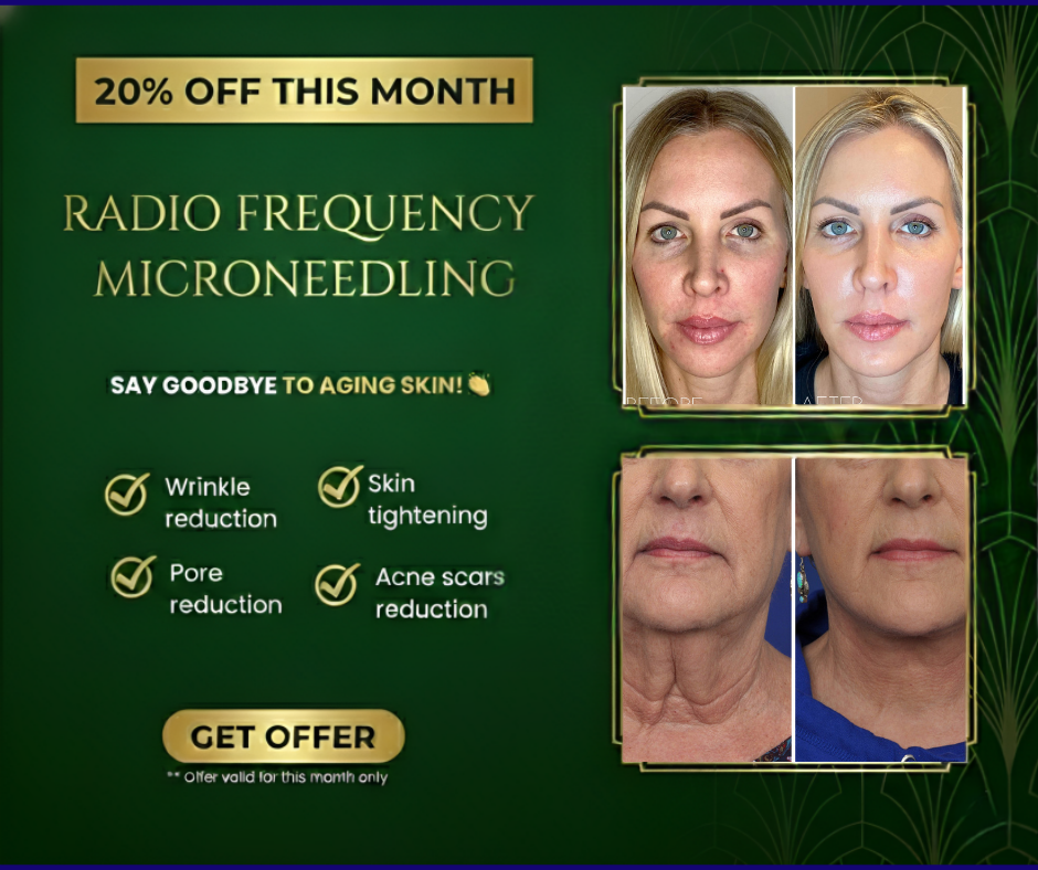 Fd aesthetics Facebook ad: 20% OFF Sylfirm X RF Microneedling