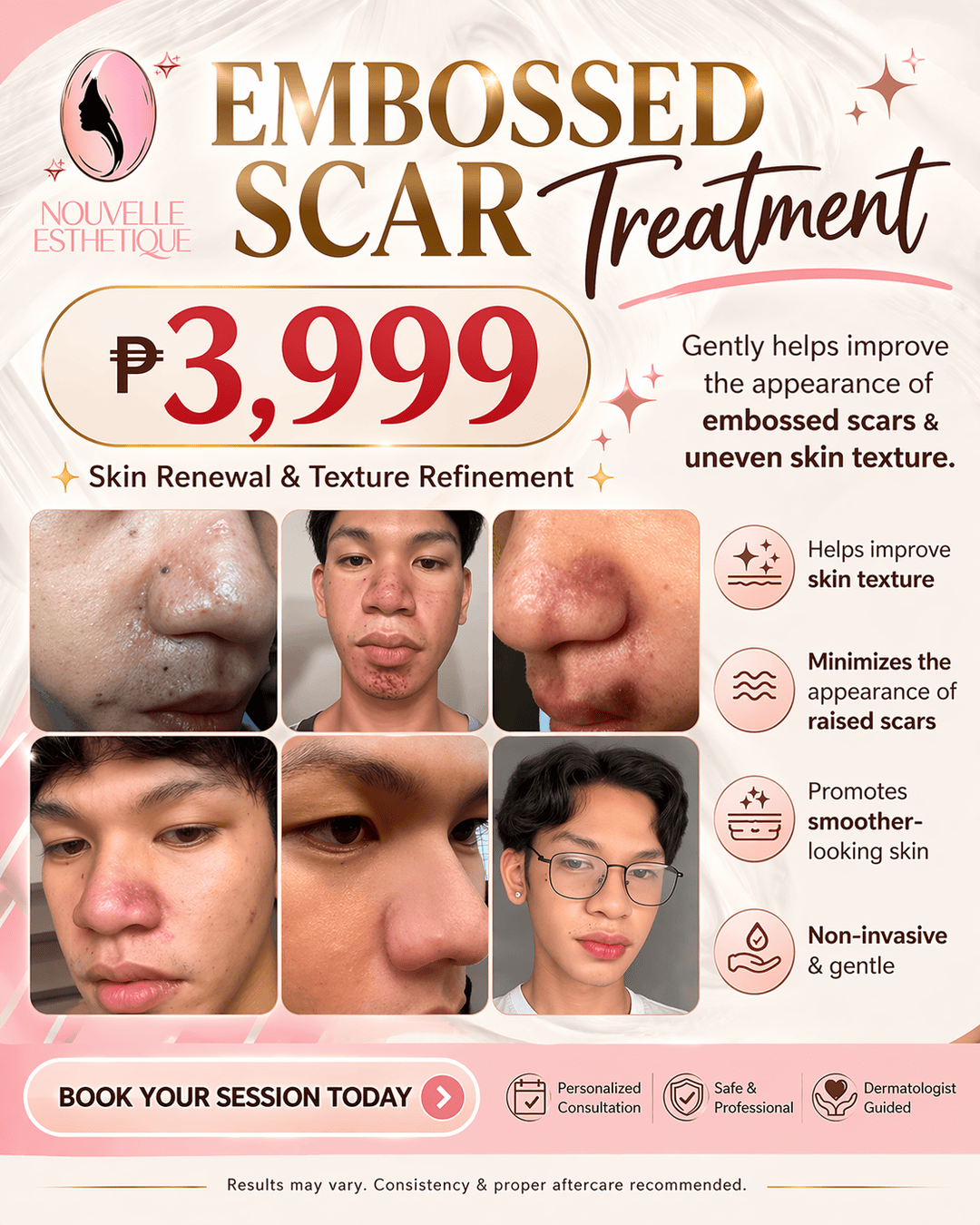 Nouvelle Esthètique CEBU Facebook ad