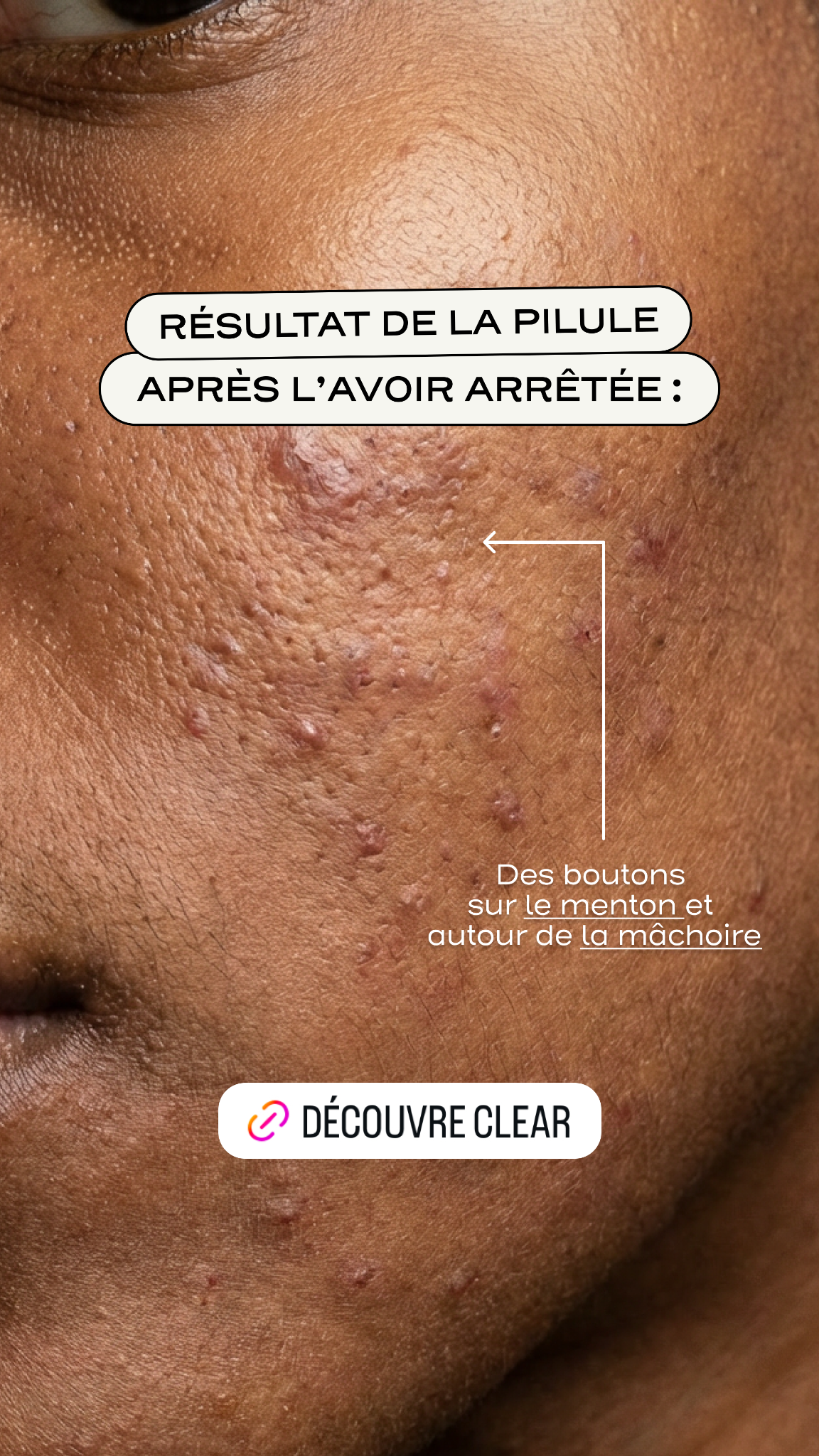 Medisite.fr Facebook ad