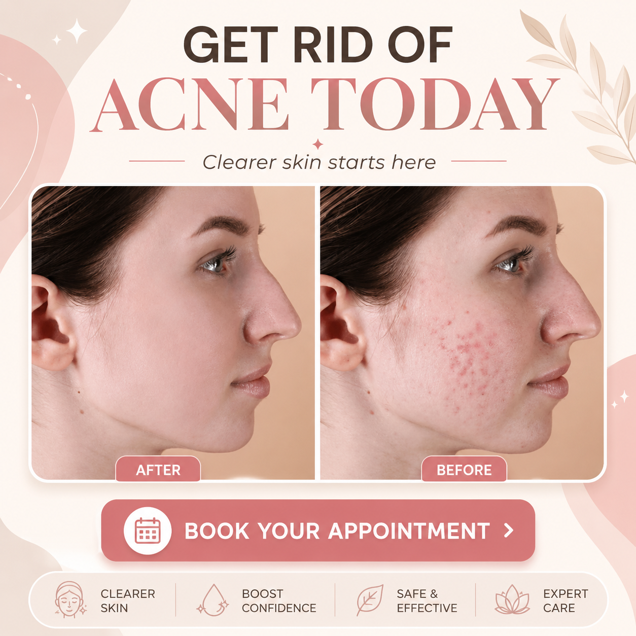 Dr Sarwat Kamran Facebook ad: Get Rid of Acne