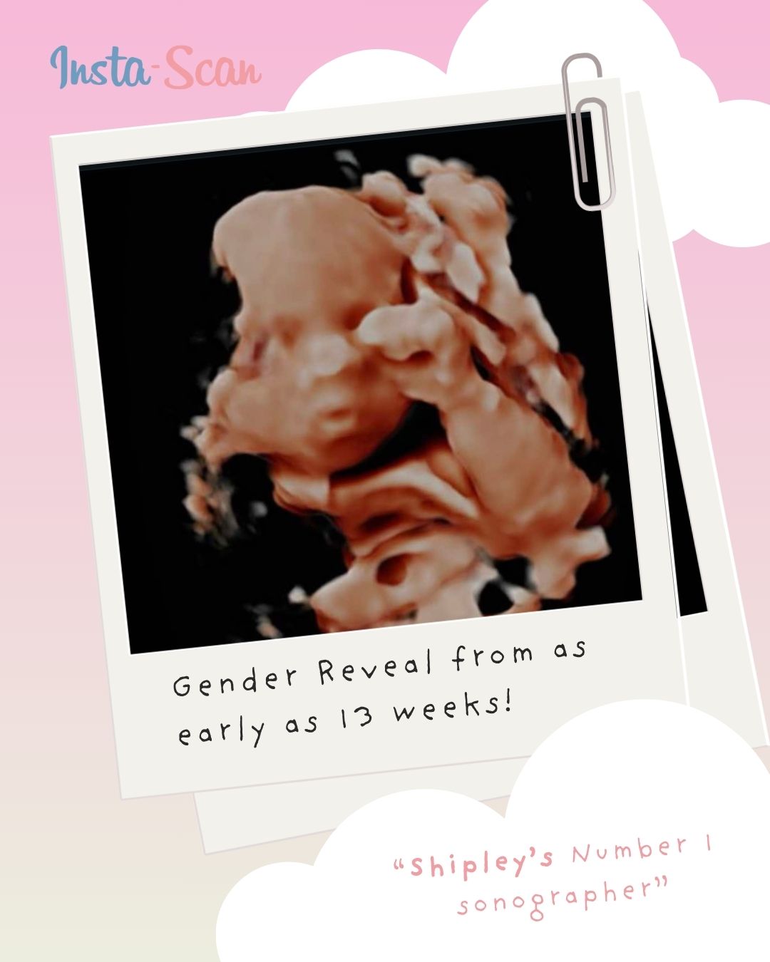 Instascan4dbaby Facebook ad: Experience the earliest scans in Shipley with a…