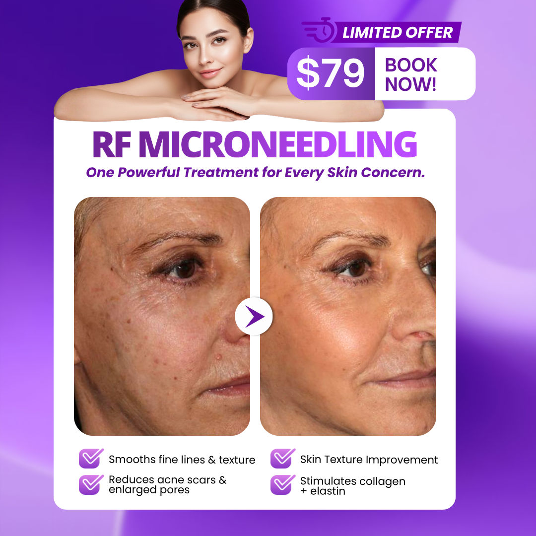 I Love Skin Treatments Facebook ad