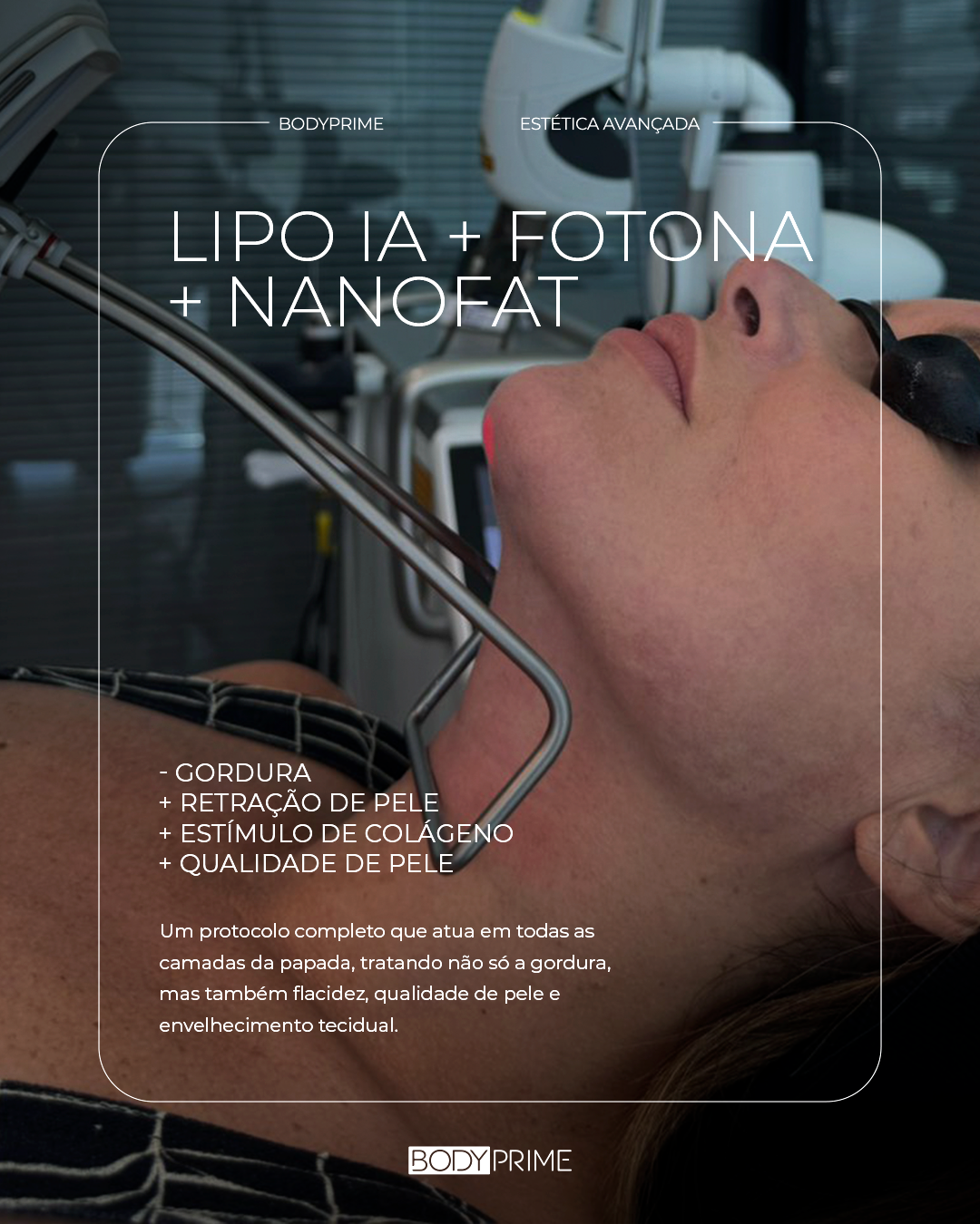 Bodyprime Leopoldo Menezes Facebook ad
