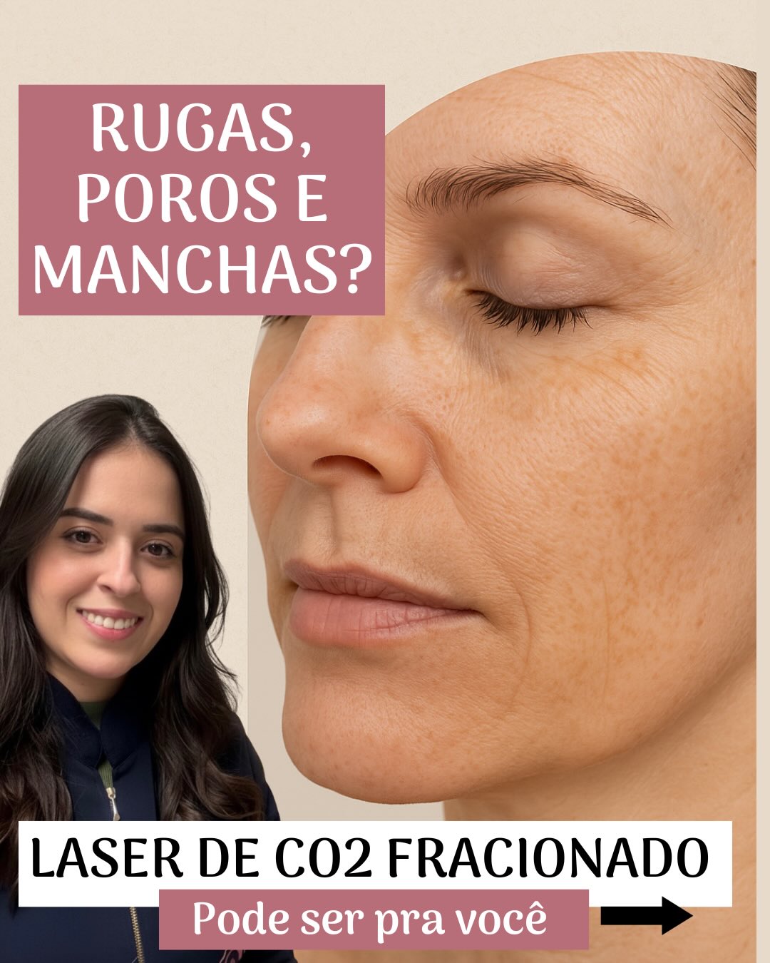 Clínica Dra. Andréa Pimentel Facebook ad: Rugas, poros e manchas?