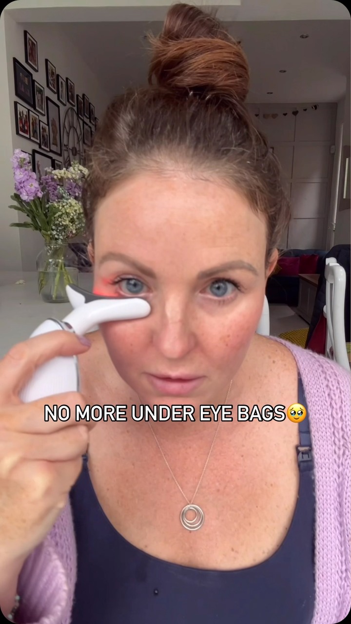 Soluna SKIN Facebook ad: No more under eye bags