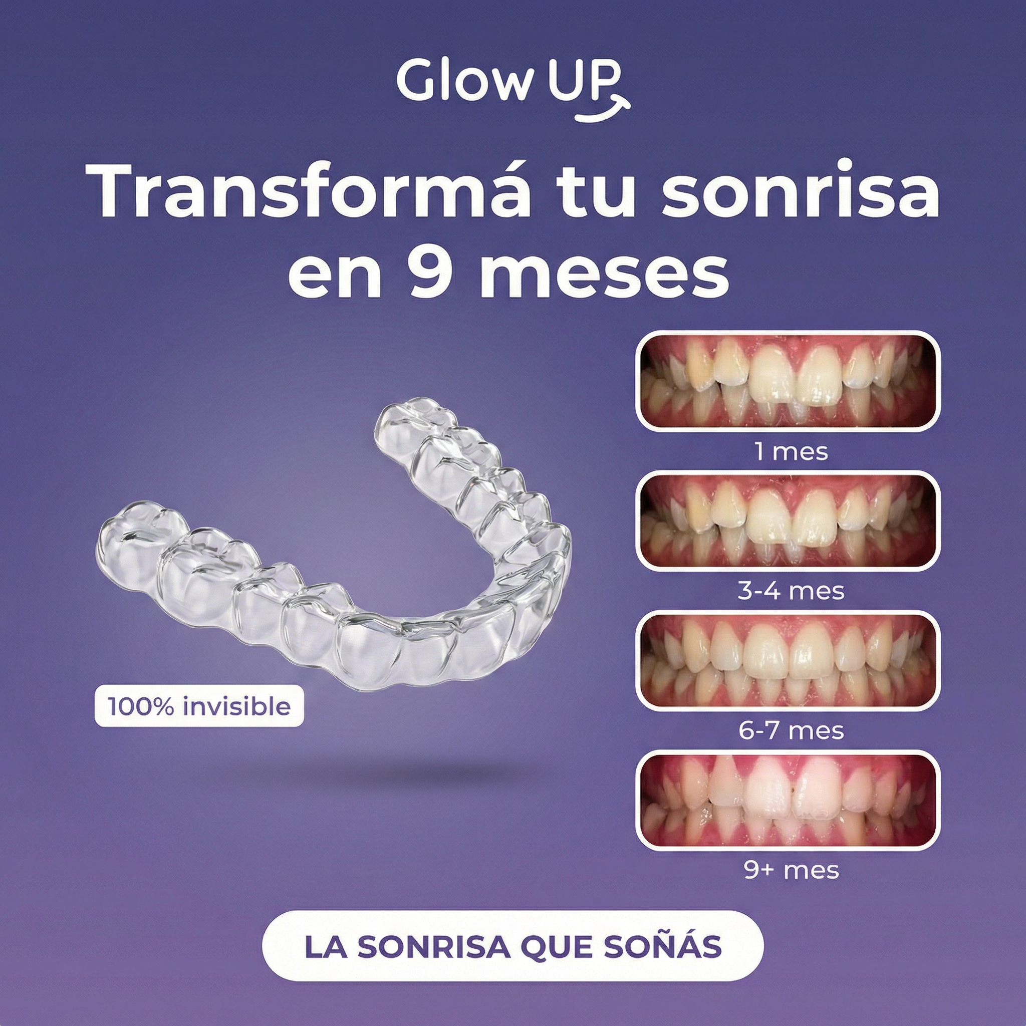 Glowup Argentina Facebook ad
