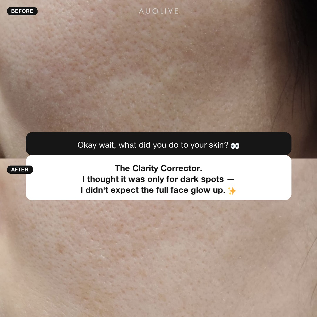 Auolive Facebook ad