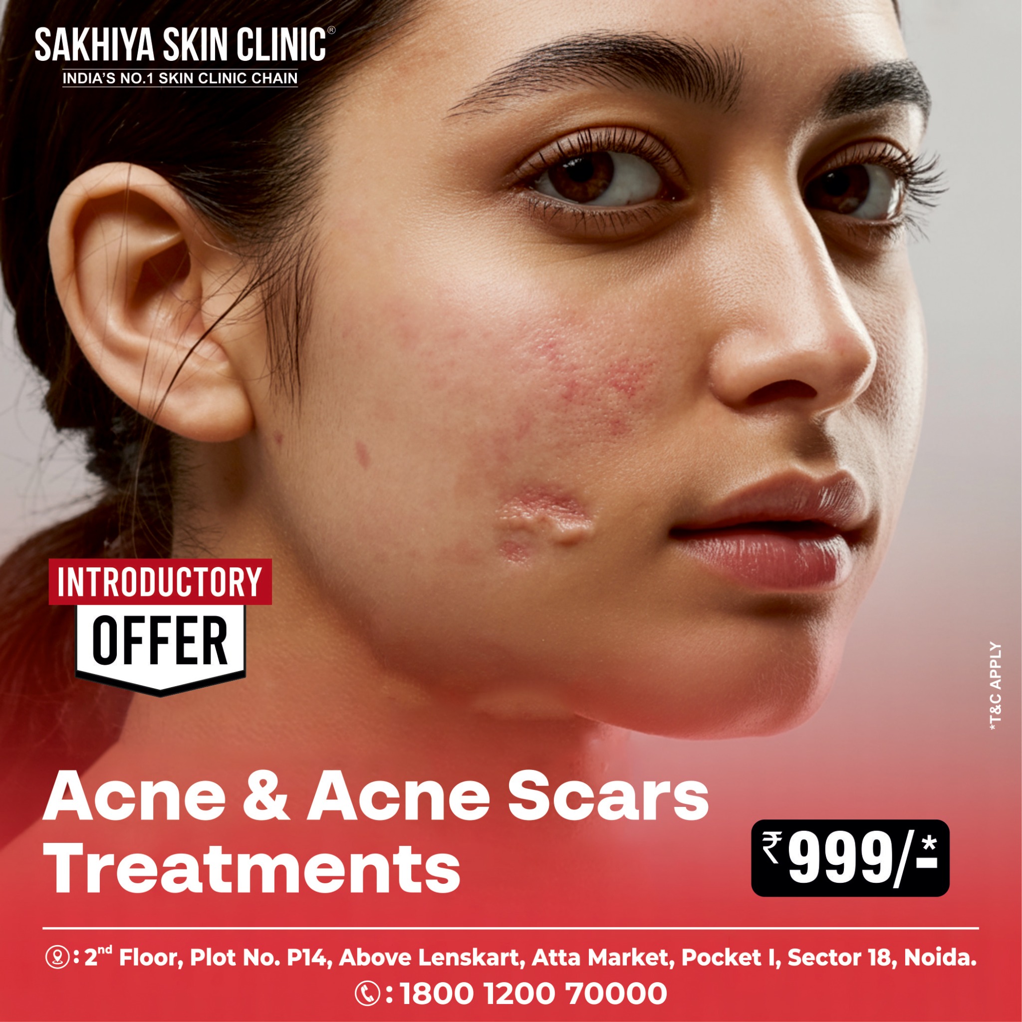 Sakhiya Skin Clinic Facebook ad