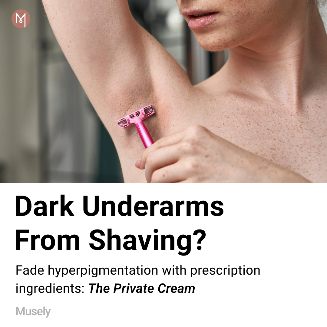 Musely Facebook ad