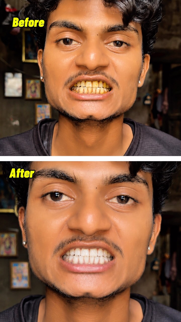 Perfora Care Facebook ad: Perfora’s Purple Teeth Whitening Serum