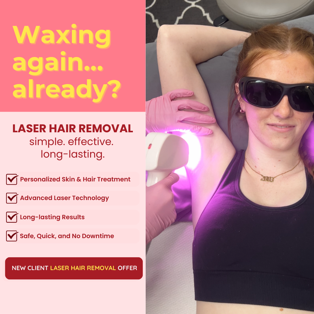 Columbia Laser Hair Removal Facebook ad: $37 Laser Hair Removal Special