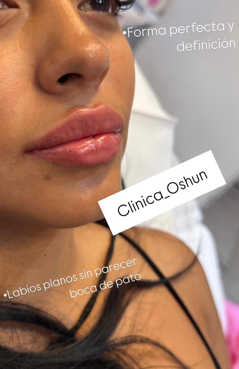 Oshun.med.asthetic Facebook ad