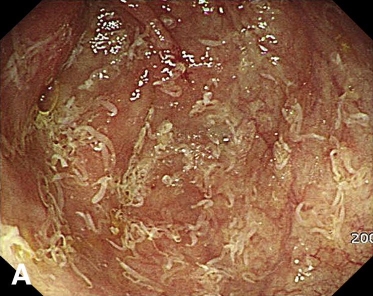 Michael Stanton, MD Facebook ad