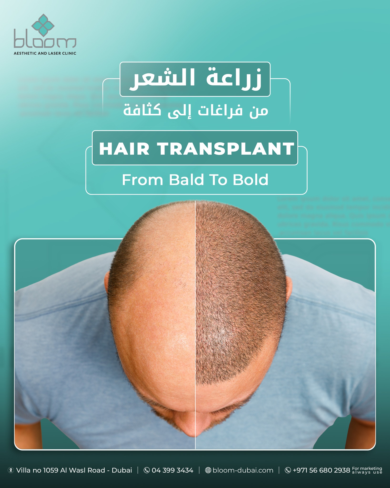 Bloom Aesthetic & Laser Clinic Facebook ad: نتائجنا غير ومضمونه وعروض مغرية استعد ثقتك بنفسك…