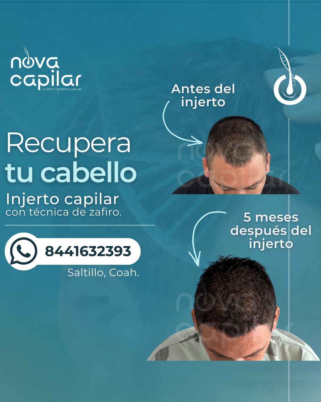 NOVA Capilar Regenerativa Facebook ad: Tu cabello merece atención experta.